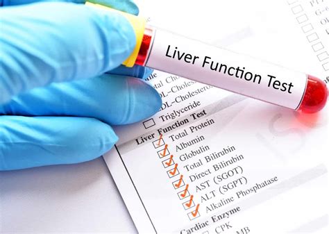 types of liver function tests